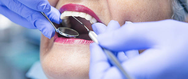Best Emergency Tooth Extraction in Afton, WY